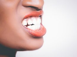 A Complete Guide on Gum Diseases and Their Treatments
