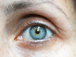 Recovery Tips for Cataract Surgery